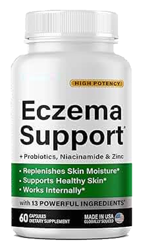 Eczema Support